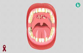 The different parts of your throat are called the oropharynx, the hypopharynx, the nasopharynx, and the larynx, or. à®µ à®¯ à®ª à®± à®± à®¨ à®¯ à®…à®± à®• à®± à®•à®³ à®• à®°à®£à®™ à®•à®³ à®š à®• à®š à®š à®®à®° à®¨ à®¤ à®¤à®Ÿ à®ª à®ª à®•à®£ à®Ÿ à®ª à®Ÿ à®¤ à®¤à®² Vai Putrunoi Oral Cancer In Tamil