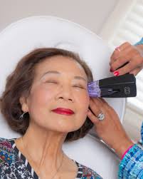 Morpheus8V is a non-surgical, minimally invasive treatment to address most  common feminine health concerns. Through radiofrequency energy and  microneedling, we can effectively tighten, enhance, and improve vaginal  health. Watch the video as