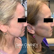 Pam Chaney Aesthetics