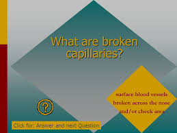 Get personalized skin care routine products by answering just a few questions to test how your skin feels throughout the day. Unit B3 E4 Revision Trivia Quiz Click For Question Ppt Download