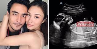 Bahkan, artis ternama malaysia nora danish ini mengaku sebagai kembaran. Zahirah Macwilson Hamil Enam Bulan Aiman Teruja Wilayahku