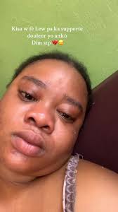 Understanding Pain Support: Insights for the Haitian Community