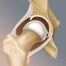 Image result for Hip Labral Tear