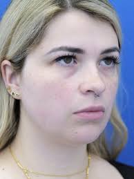 Cases in COSMETIC SURGICAL