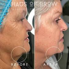 Advanced Aesthetics Clinic Coleshill