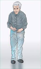 Maybe you would like to learn more about one of these? Parkinson S Disease The Lancet