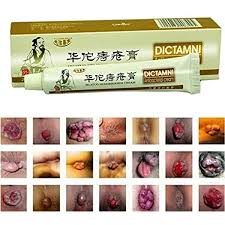 See more ideas about hemorrhoids, cure for hemorrhoids, hemorrhoids treatment. Amazon Com Dictamni Chinese Herbal Hemorrhoid Relief Cream Rapid External Hemorrhoids Treat Health Personal Care