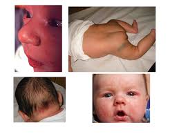 We did not find results for: Il Neonato Ppt Scaricare