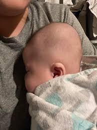 متى يكون اختلاف شكل رأس الطفل طبيعيًا ولا يستدعي القلق؟