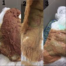 Cirit birit adalah keadaan di mana anda membuang air besar dengan lebih banyak dan kerap berbanding biasa. Bayi Cirit Birit 11 Kali Sehari Gara Gara Minum Susu Tiruan Geng Wokyoh