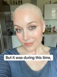 Lauren Oconnell Survivor Before and Agter