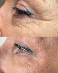 Sonia Marques Medi Aesthetics (@soniamarquesmediaesthetics) • Instagram  photos and videos