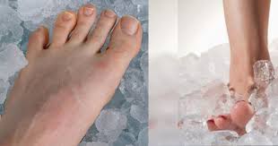 Merendam kaki dengan air garam. Amalkan Rendam Kaki Dalam Ais Supaya Atasi Sakit Kepala Sukar Tidur Dan Sakit Badan Serta Gangguan Makhluk Halus Keluarga