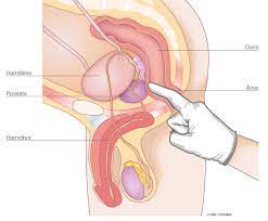 Prostata untersuchung ab wanna one vesical. Digitale Rektale Untersuchung Dru Farco Pharma