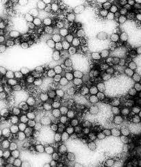 Chiefly canadian acute depression resulting from being isolated or sharing. Yellow Fever Definition And Synonyms Of Yellow Fever In The English Dictionary