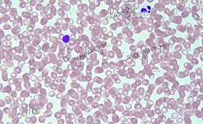 Solved Draw And Label A Neutrophil Lymphocyte And Eryth Chegg Com In this short course, you'll learn the principles behind nucleus and how to apply it to your next. draw and label a neutrophil lymphocyte
