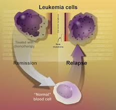 The different types of leukemia are varied in their presentation, age of onset, risk factors and outlook. Leukemia Lab Tests Online
