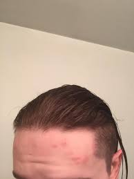 If you have detected a bed bug infestation within your home, contact a pest control. I Ve Got Bed Bugs Give Me A Hair Cut To Match Justfuckmyshitup