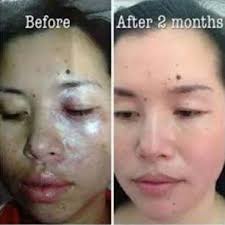 Miracle Before Your Eyes