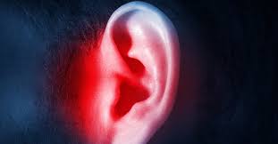 Image result for Mastoiditis