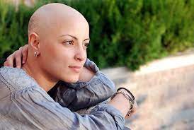 Sometimes your eyelash, eyebrow, armpit, pubic and other body hair also falls out. Can Hair Loss Through Chemotherapy Be Treated