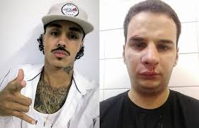 Horas antes, mc livinho preocupou os seus fãs ao postar um pedido de ajuda. Mc Livinho E Acusado De Agredir Funcionario Nao Vou Colocar Uma Mascara Para Mentir Viver Diario De Pernambuco