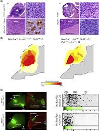 Watch trump destroys the illuminati best speech you will ever see! Neuronal Migration In The Developing Cerebellar System Sciencedirect