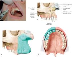 Image result for Periapical Block