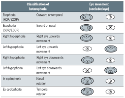 Image result for Extraocular Movement