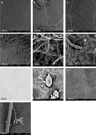 Image result for Botrytis cinerea