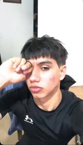 Cara Melancolica Corte De Pelo