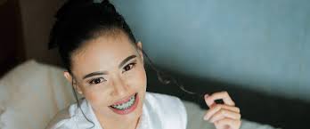 Following the removal of your braces, your teeth will need a thorough cleaning. Why Does My Orthodontist Only Want To Remove Two Teeth In The Upper Arch Affordable Braces Jorgensen Orthodontics