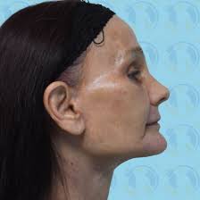 Top Plastic Surgeon Tijuana, Mexico