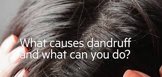 So factors like our diet and hair care play a vital role in preventing a dry scalp from forming. What Causes Hair Dandruff