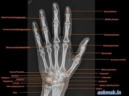 Image result for Wrist XRay