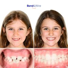 Band & Wire Orthodontics and Pediatric Dentistry