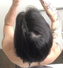 Do I Have A Bald Spot Or Is This Just A Weird Part Ive Always Had This Spot On The Back Of My Head Hair Beauty Celebrity Hair Colors Long Hair