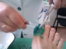 Snyatie Shvov Youtube