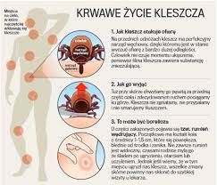 Check spelling or type a new query. Kleszcze W Natarciu Coraz Wiecej Przypadkow Boreliozy