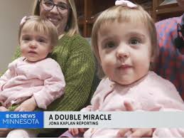 Children's Minnesota Pull Off Double Miracle For Young Twins With Rare  Heart Condition