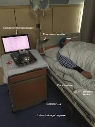 Image result for Bladder Irrigation