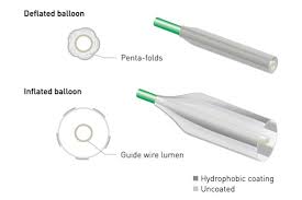 Zilver® ptx® (cook medical, bloomington, in, usa) and eluvia (boston . Passeo 18