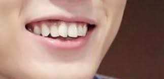 There is something i really want to tell you today, so i am writing this. Ikon Yg Bobby And Hanbin Have Both Crooked Teeth In Facebook