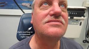 Image result for Dissotis glandulosa