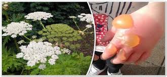 Большая часть борщевиков зацветает в мае, но продолжительность цветения у каждого вида своя. Borshevik Chto Eto Chem Opasno Kak Pomoch Novosti Guo Yasli Sad 20 G Novopolocka