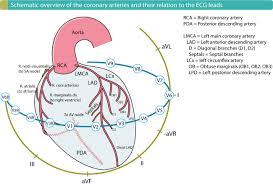 Ecg Localization Of Myocardial Infarction Ischemia And