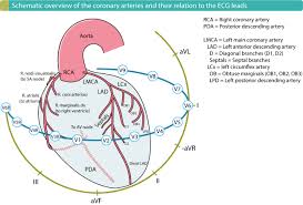 ecg localization of myocardial infarction ischemia and