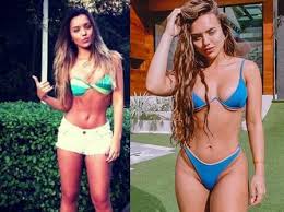 Pessoas com o rosto mais cheinho não notam tanta diferença, já pessoas com o rosto mais. Meus Lindos E Pagos Famosas