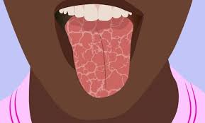 Maybe you would like to learn more about one of these? ØªØ¬Ø±Ø¨ØªÙŠ Ù…Ø¹ ØªØ´Ù‚Ù‚Ø§Øª Ø§Ù„Ù„Ø³Ø§Ù† Ø¥ÙŠØ¬ÙŠ Ø¨Ø±Ø³