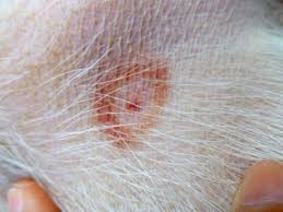 Allergic Reaction Black Ant Bites Pictures Pin On Pet Care Etc